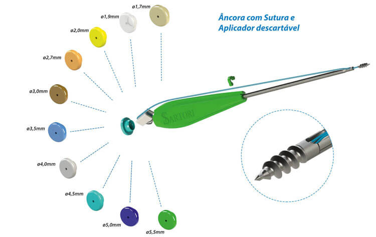 ancora com sutura e aplicador descartável sartori