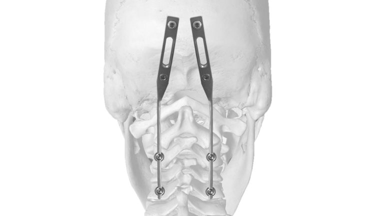 neuro-france-implants-joc-3